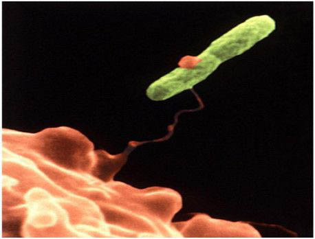 legionella